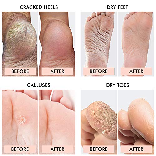 Foot Peel Mask- Deeply Exfoliates and Peels Away the Dead Skin, Cracks & Calluses,repairs rough heels revealing baby soft feet-Pack of 2 Pairs of Plastic Foot Mask for Men and Women (Lavender)