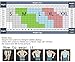 Hanerdun Mens Slimming Body Shaper Vests Undershirt Abs Abdomen Slim, Black - XL Size
