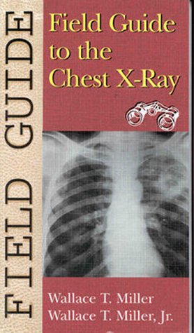 [B.O.O.K] Field Guide to the Chest X-Ray (Field Guide Series) [R.A.R]