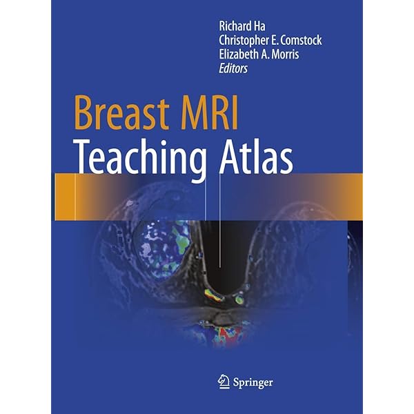 Breast Ultrasound by A.Thomas Stavros (2003-12-01): A. Thomas
