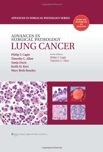 Advances in Surgical Pathology: Lung Cancer
