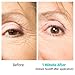 Nunutrients Facelift Anti Aging Serum, Can be Mixed with Make Up – Reduces Common Signs of Skin & Eye Aging, Appearance of Fine Lines, Wrinkles + Fights Sagging & Crows Feet! Provided in Pump Dispenser – Get the Skin-tone You want