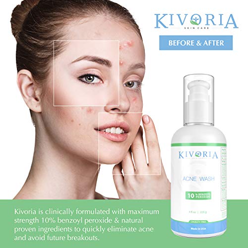 Kivoria MaximumStrength Acne Wash 10 Benzoyl Peroxide Acne