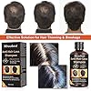 Anti-Hair Loss Shampoo, Hair Growth Shampoo, Effective Solution for Hair Thinning & Breakage, Helps Stop Hair Loss, Grow…