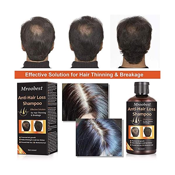 Anti-Hair Loss Shampoo, Hair Growth Shampoo, Effective Solution for Hair Thinning & Breakage, Helps Stop Hair Loss, Grow…
