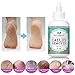 Maccibelle Callus Remover Extra for Feet, Professional Callus and Corn Eliminator Liquid Gel (4 Ounce)
