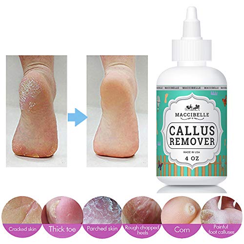 Maccibelle Callus Remover EXTRA For Feet, Professional Callus and Corn Eliminator Liquid Gel 4 oz