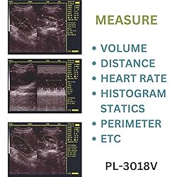 2023 Convex Newest Ultrasound Machine for Pregnancy