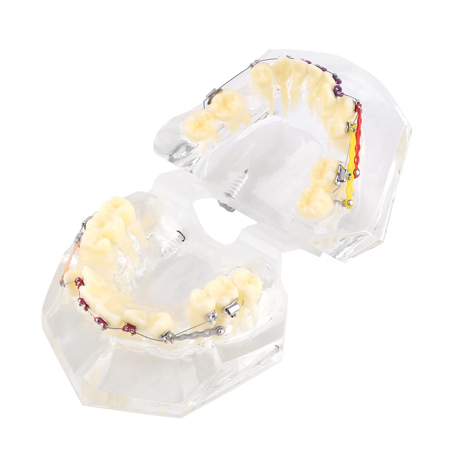 Orthodontic Model, Teeth Model Professional Design with Wire Chain for Dental Cure
