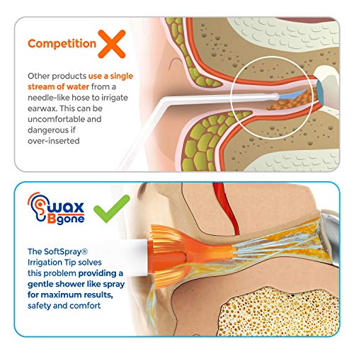WaxBgone Ear Wax Removal Kit with SoftSpray Ear Irrigation Tips for