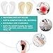ASRAM (12PCS) Arch Support,Soft Gel Insole Pads,High Heel Inserts Reusable Arch Cushions Best for Plantar Fasciitis and Flat Feet,Arch Pain Relief, for Men and Women. 3