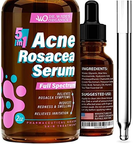 acne rosacea serum