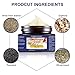 Fungus Treatment Cream,Nail Fungus Cream,Foot Fungus,Fungus Stop,Anti fungal Nail,Restores The Healthy Appearance of Nails Discolored or Damaged by Nail Fungus…
