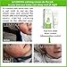 Eczema cream LEMYKA, Natural anti itch relief, hives, Contact Dermatitis Treatment, Itchy dry skin, Dyshidrosis, diaper rash cream, Steroid free, pure plant actives: 10X Shea, aloe vera, ceramides