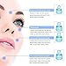 Blackhead Remover, Pore Vacuum, Blackhead Vacuum Rechargeable Electric Facial Pore Cleaner Blackhead Extractor Tool Acne Comedone Removal Suction Beauty Device for Facial Skin