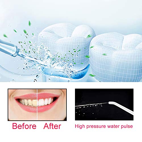 Water Dental Flosser,Anbanglin Cordless 10oz/300mL Professional Oral Irrigator, Portable and Rechargeable Waterproof with 3 Modes 4 Jet Tips Water Flossing for Home and Travel Use