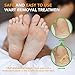 Samsali Wart Remover Pads, Highly Potent Wart Removal Treatment, All New Premium High Efficacy Wart Remover Pads, 42 Wart Remover Padsthumb 3