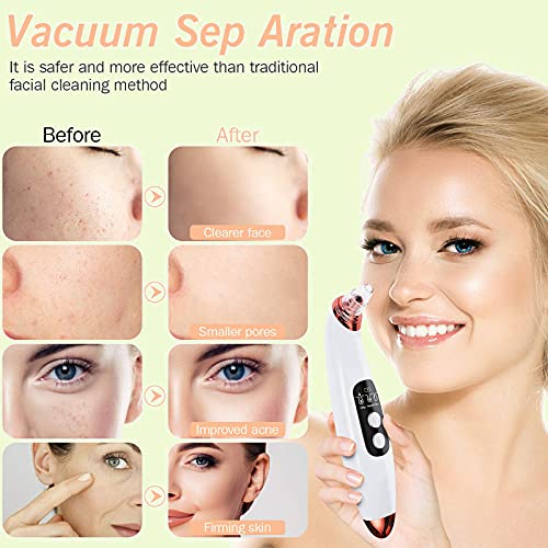 Blackhead Remover Pore Vacuum CleanerAMVOOM Upgraded Blackhead Acne