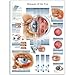 3B Scientific VR1231UU Glossy Paper Diseases of The Eye Anatomical Chart, Poster Size 20