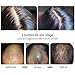 Hair Growth Product, Hair Regrowth, Hair Growth Essence Spray, Hair Loss Prevention, Hair Loss &Hair Thinning Treatment, Stimulates New Hair Growth, Best Treatment for Hair Lossthumb 3