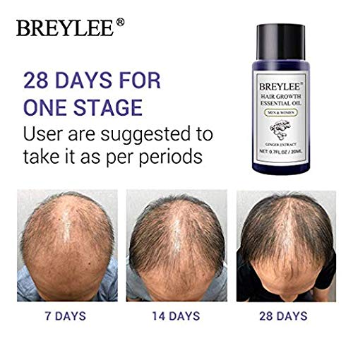 Vividy Moisturizing Damaged Hair Repair Growth Essence Treatment Oil Hair Regrowth Treatments