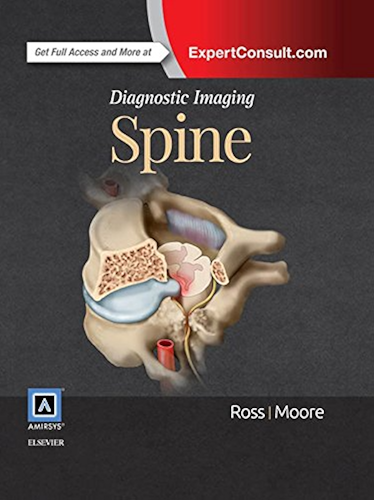 Download Diagnostic Imaging: Spine E-Book (English Edition) PDF