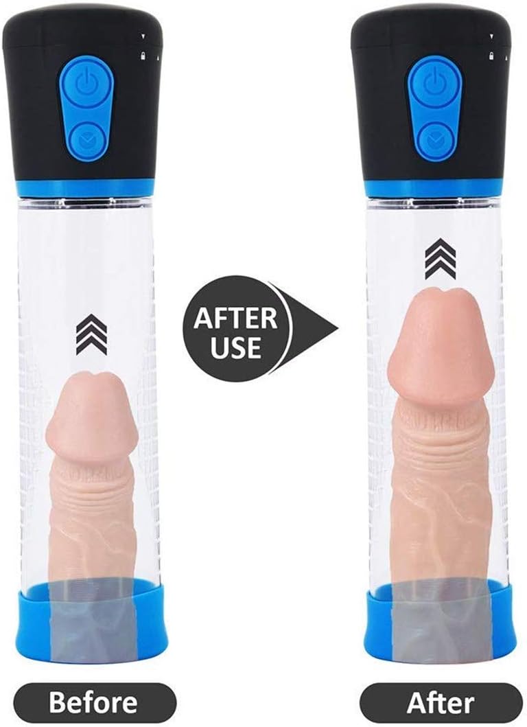 Male Electric Ƥên?s Pump Vacuum Exericiser Device Battery Powered with One-Click Release Effective Increase The Size and Strength