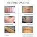 Silicone Scar Gel Away Strips Scar Remover Treatment Strips, Reusable Medical-Grade Silicone Gel Sheets Help to Remove The Old Scars, Acne Scar, Trauma, Burn Scar, hypertrophic Scars.