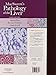MacSween's Pathology of the Liver: Expert Consult: Online and Print