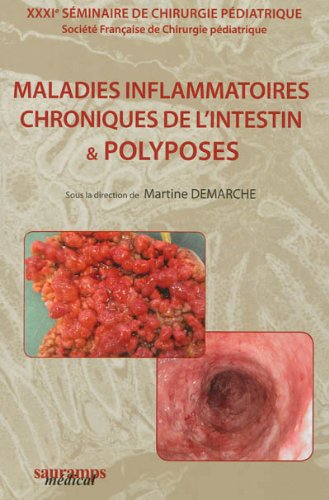 Maladies inflammatoires chroniques de l'intestin & polyposes