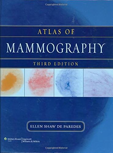 Download Atlas of Mammography PDF