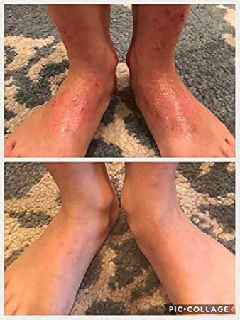 neora prolistic lotion reviews