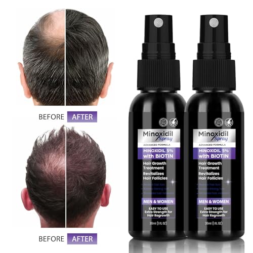 Minoxidil 5% for Men Women, 2 pcs 30ml Minoxidil for Women Hair Growth, Minoxidil for Men Hair and Beard Growth Spray, with Biotin and Minoxidil Extract Serum for Hair Loss and Thinning