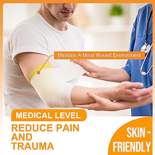 Carbou 4"x4" Medical Xeroform Petrolatum Dressing, Non-Adherent Gauze Pads, Soft Fine Mesh Gauze Patch for Wound Care, Burns, Lacerations, Skin Grafts & Surgical Incisions, 25 Individual Pack