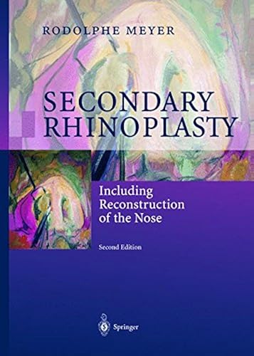 Download Secondary Rhinoplasty: Including Reconstruction of the Nose PDF