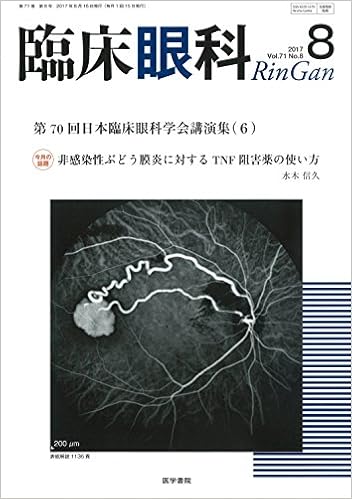 臨床眼科 2017年 8月号 特集 第70回日本臨床眼科学会講演集 6 本 通販 Amazon
