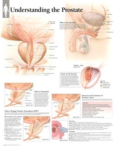Understanding the Prostate Educational Chart Poster 22 x 28in with Poster Hanger