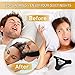 Sisufy Anti Snoring Chin Strap - Premium Snoring Solution and Anti Snoring Devices - Snoring Chin Strap for CPAP Users - Stop Snoring Sleep Aid for Mouth Breathers