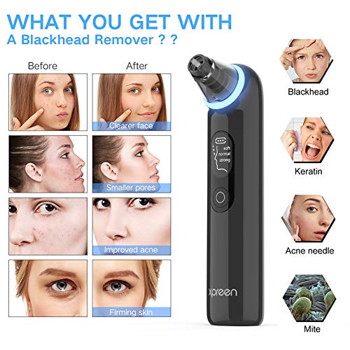 Blackhead Remover Vacuum, Xpreen Pore Cleanser Vacuum with Blue Light - Blackhead and Comedone Acne Extractors - Whitehead Removal, Facial Firming, Oil Reducing for Women & Men - Thumbnail 6