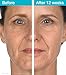 MD Complete Total Eye Care Wrinkle Corrector Treatment Under Eye Cream for Wrinkles Brightening Firming Crows Feet Anti Aging Eye Cream for Puffiness Night Moisturizer Hydrating TET