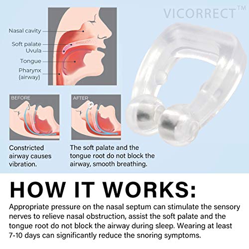 Vicorrect Upgraded Anti Snoring Devices, 4 Nose Clips with 4