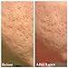 Advanced Microdermabrasion Scrub, A Natural Exfoliating Facial Scrub for Face, Hands & Neck & Décolleté, Anti Aging Skin Care, Proven to Minimize Pores, Wrinkles, Acne Scars & Remove Blackheads.