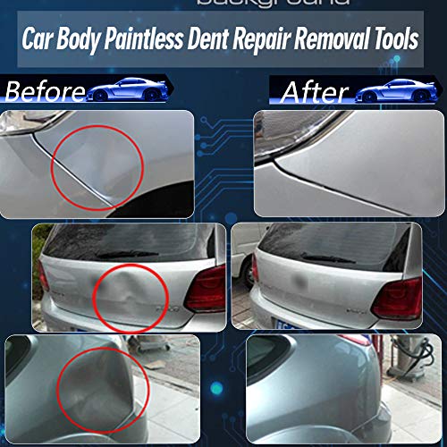 Anyyion 98pcs Paintless Dent Repair Kits,Car Body Dent Repair Tools