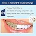 Teeth Whitening Pen, Safe 35% Carbamide Peroxide Gel, 20+ Uses, Painless, No Sensitivity, Easy to Use, Natural Mint Flavor