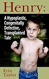 A Hypoplastic, Congenitally Defective, Transplanted Tale