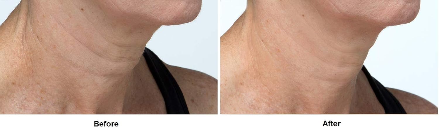 dennis gross neck emulsion