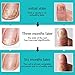 Y.F.M Toenail Treatment, Toenail Care, Nail Treatment Pen Nail Gel, Effective Nail Treatment, Toenails & Fingernails Solution, 3 ml