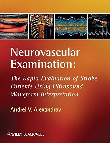 Neurovascular Examination: The Rapid Evaluation of Stroke Patients Using Ultrasound Waveform Interpretation