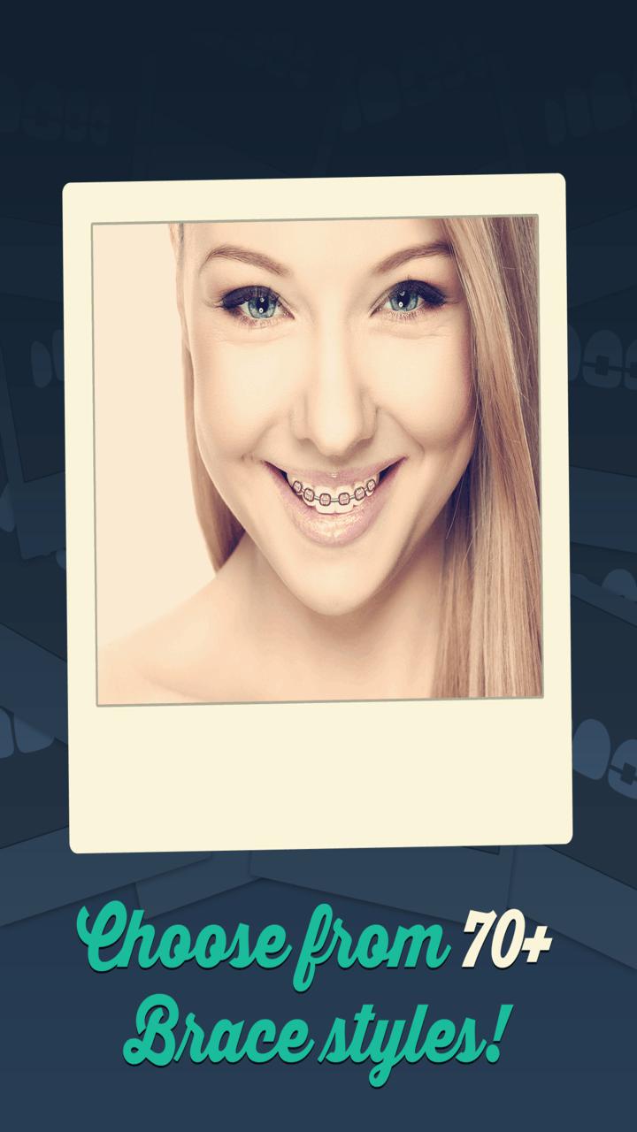 Brace Yourself The Brace Booth Put Dental Braces On Your Teeth Free