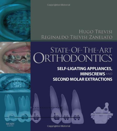 State-of-the-Art Orthodontics: Self-Ligating Appliances, Miniscrews and Second Molars Extraction, 1e, by Hugo Trevisi DDS, Reginaldo C. Tr